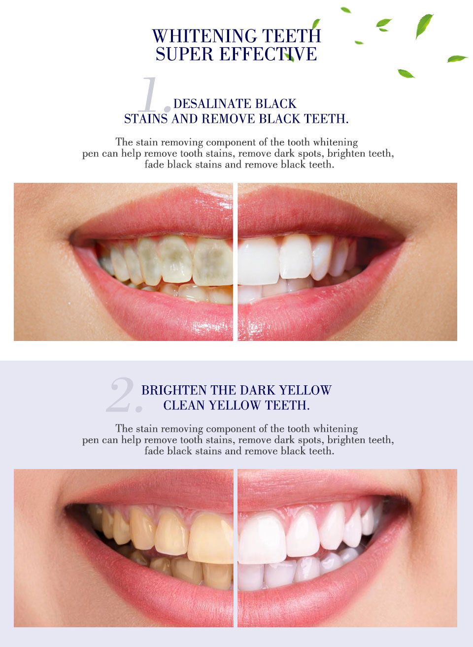 עט להלבנת שיניים ibcccndc