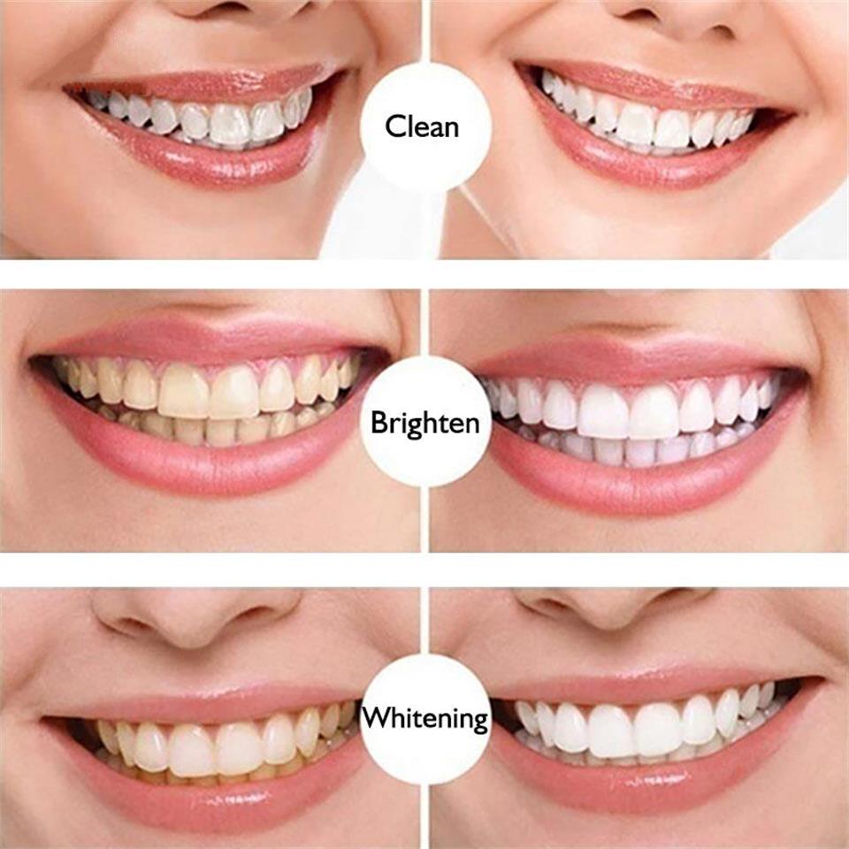 עט להלבנת שיניים ibcccndc