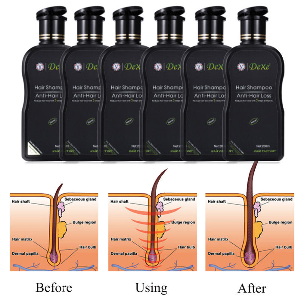 Dexe – שמפו אורגני למניעת נשירה ולחידוש צמיחת השיער