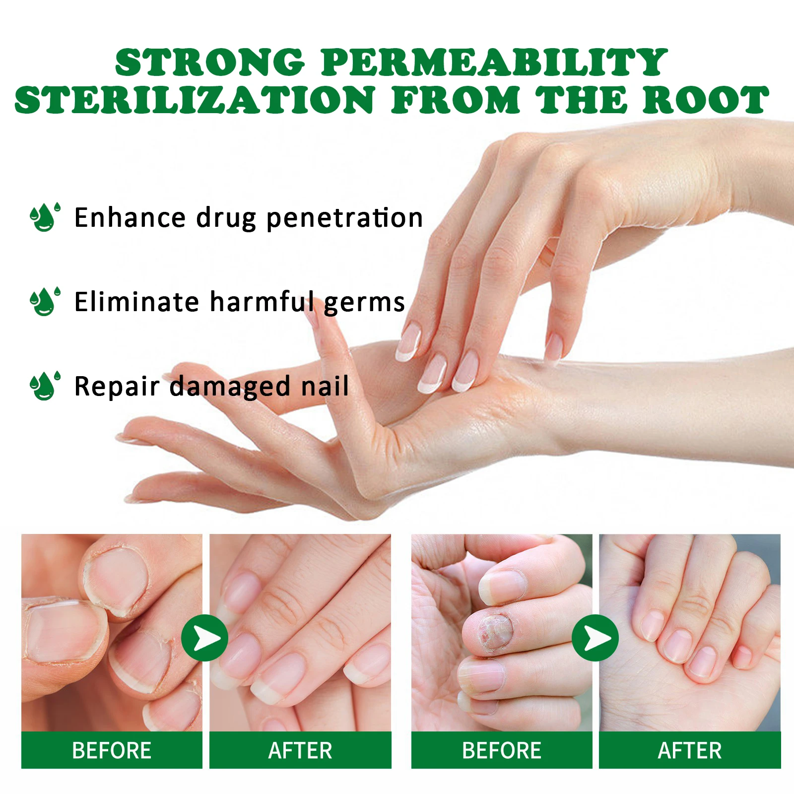 Nail Fungal Treatment Essential Oil Nail Fungus Removal Serum Foot Toe Onychomycosis Repair