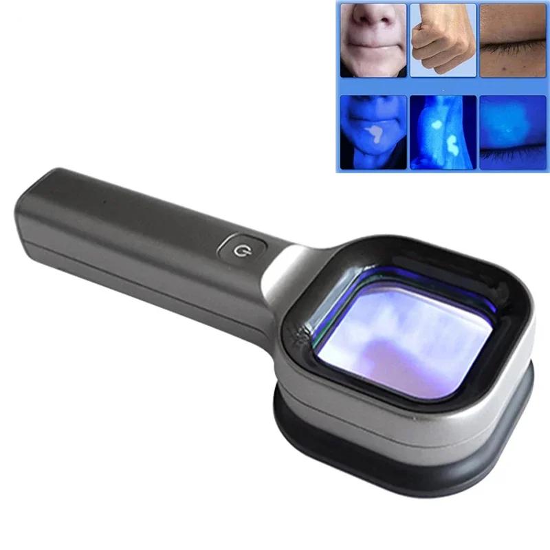 מנורת UV לאבחון עור עם מגדלת לרפואה וווטרינריה