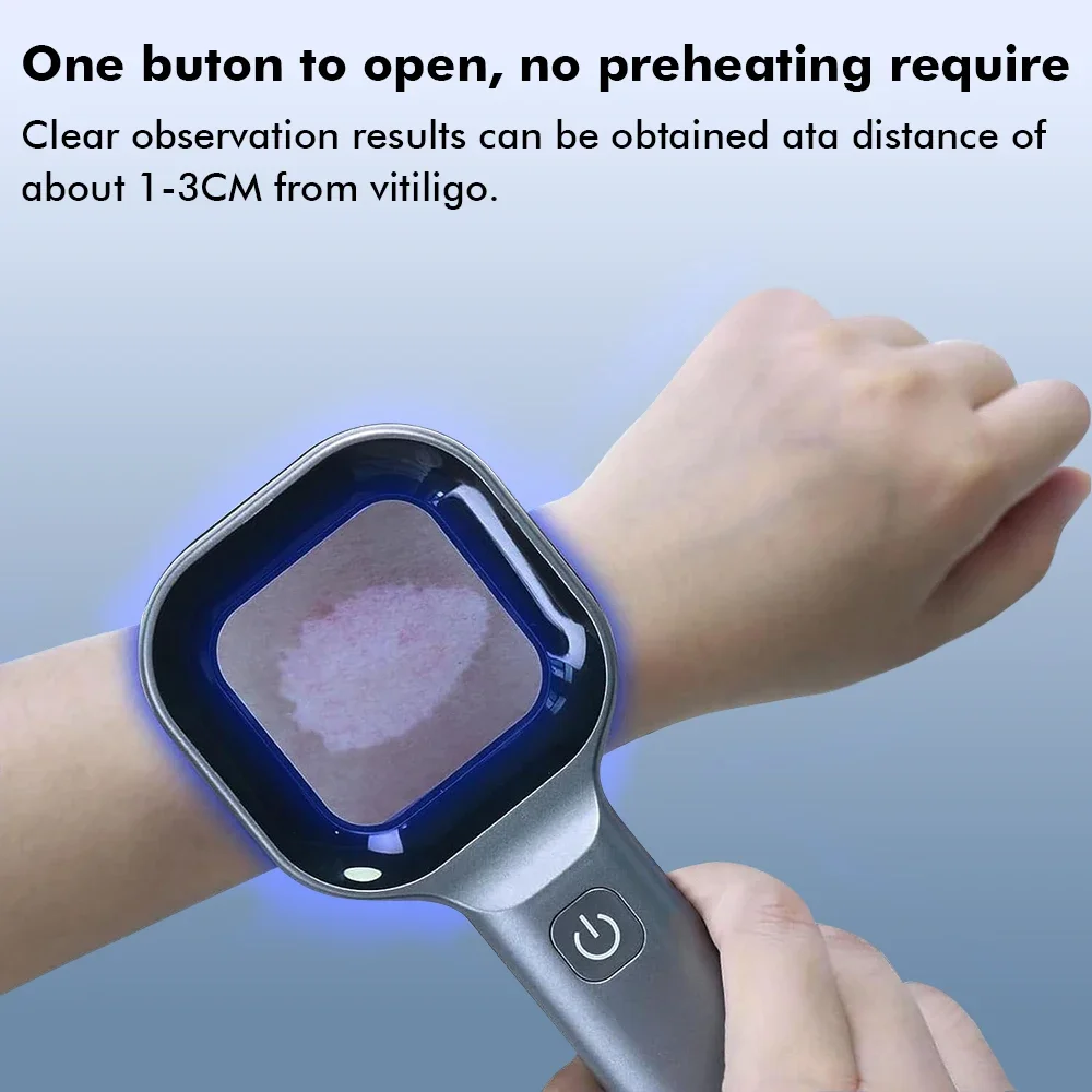 מנורת UV לאבחון עור עם מגדלת לרפואה וווטרינריה – תמונה 4