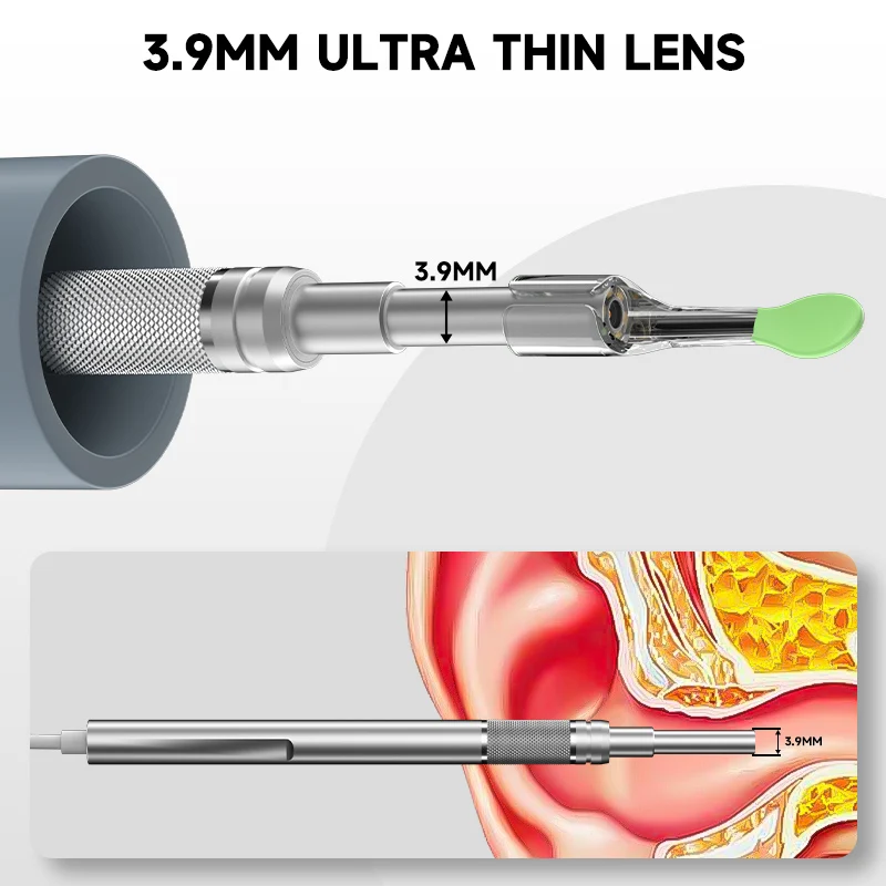 אוטוסקופ דיגיטלי עם מסך 4.5 אינץ' ועדשה דקה 3.9MM – תמונה 4