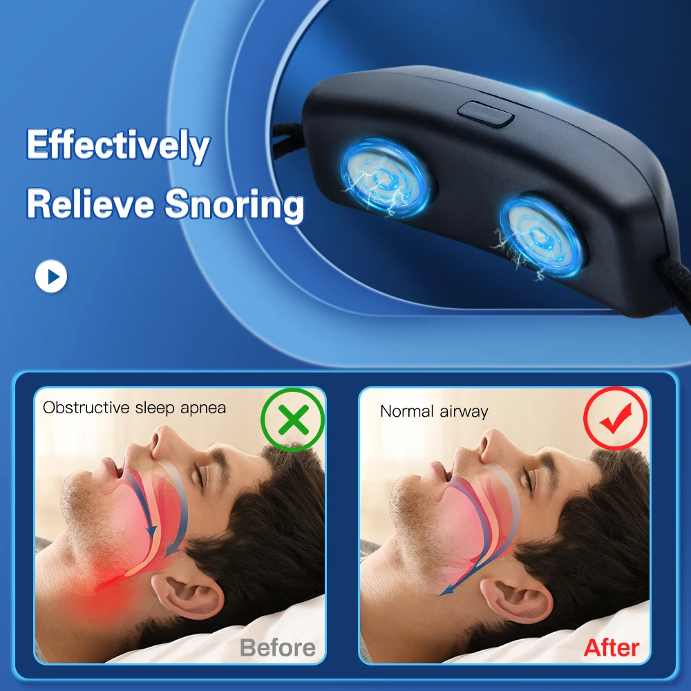 מכשיר נגד נחירות חכם EMS עם חיישן בינה מלאכותית, 5 רמות עוצמה וטעינת USB-C – תמונה 5